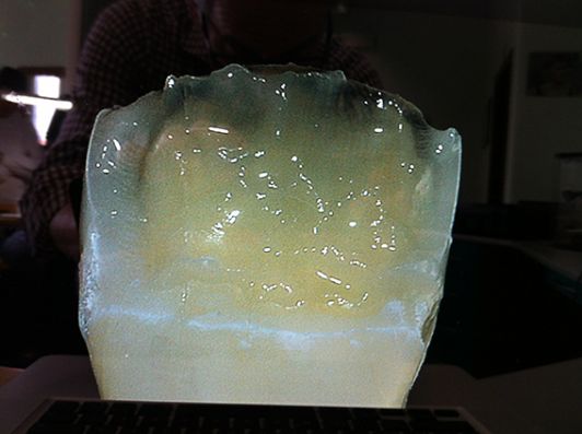 Dentsply Dibi Dentali